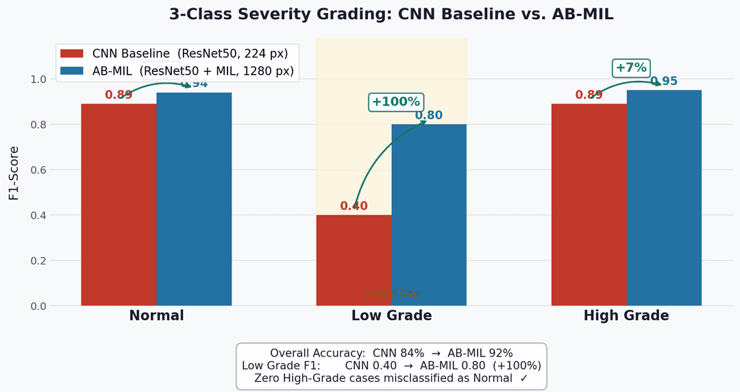 AB-MIL versus CNN F1 score comparison chart