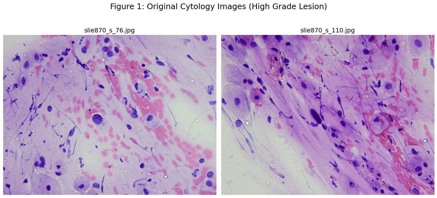 Original Cytology