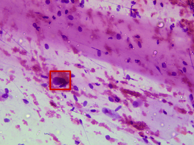 Pap Smear FOV