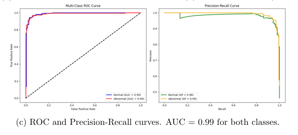 ROC / Precision-Recall Curves